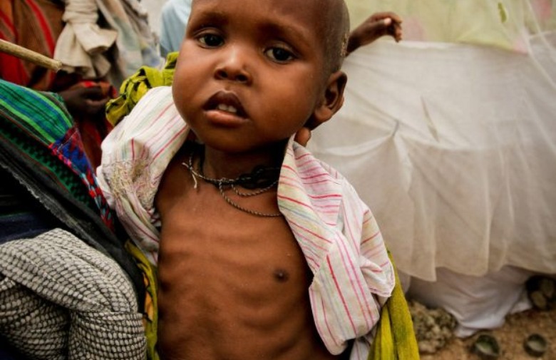 UNICEF: od šestero djece u svijetu pet je pothranjeno