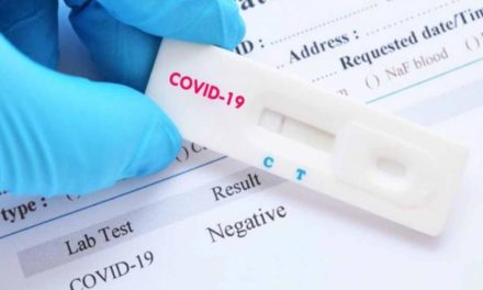 Na koronavirus testiran 251 uzorak, samo jedan nalaz pozitivan