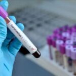 Novih 160 slučajeva koronavirusa u Županiji Zapadnohercegovačkoj